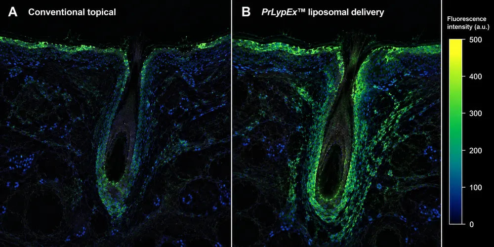 Fluorescence comparison of conventional topical delivery and PrLypEx liposomal delivery around the hair follicle