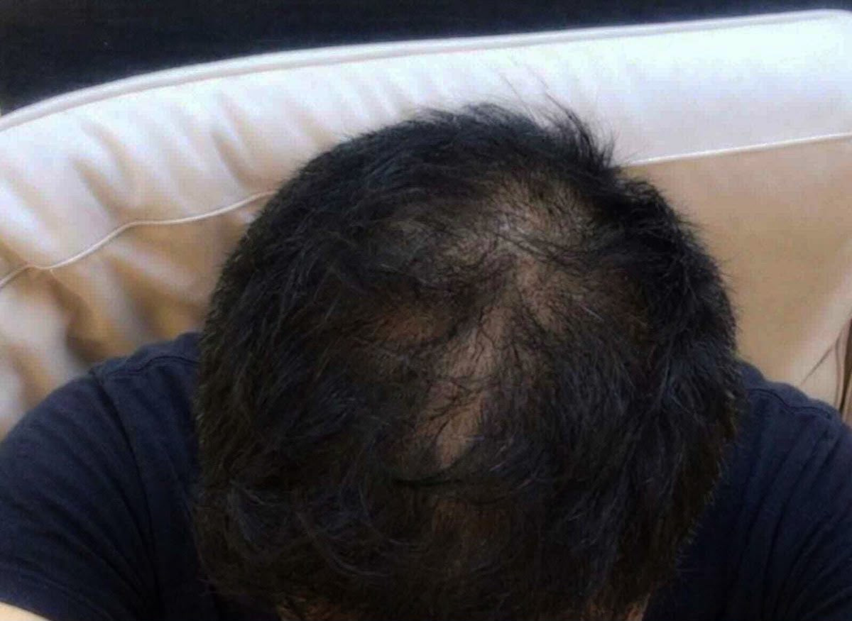 Arjun's hair before using Enigma