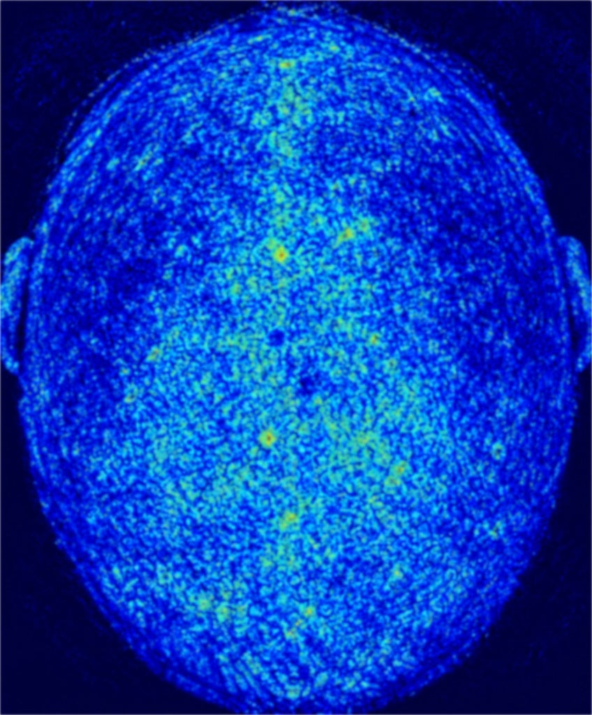 Relative scalp microcirculation signal before applying serum