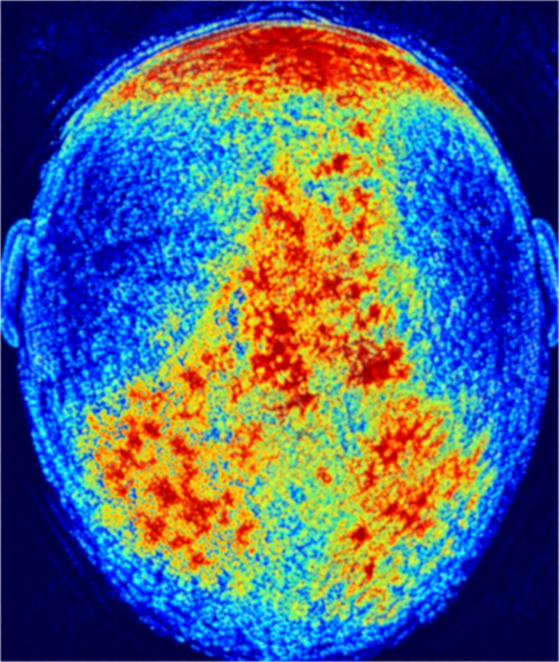 Relative scalp microcirculation signal after applying serum