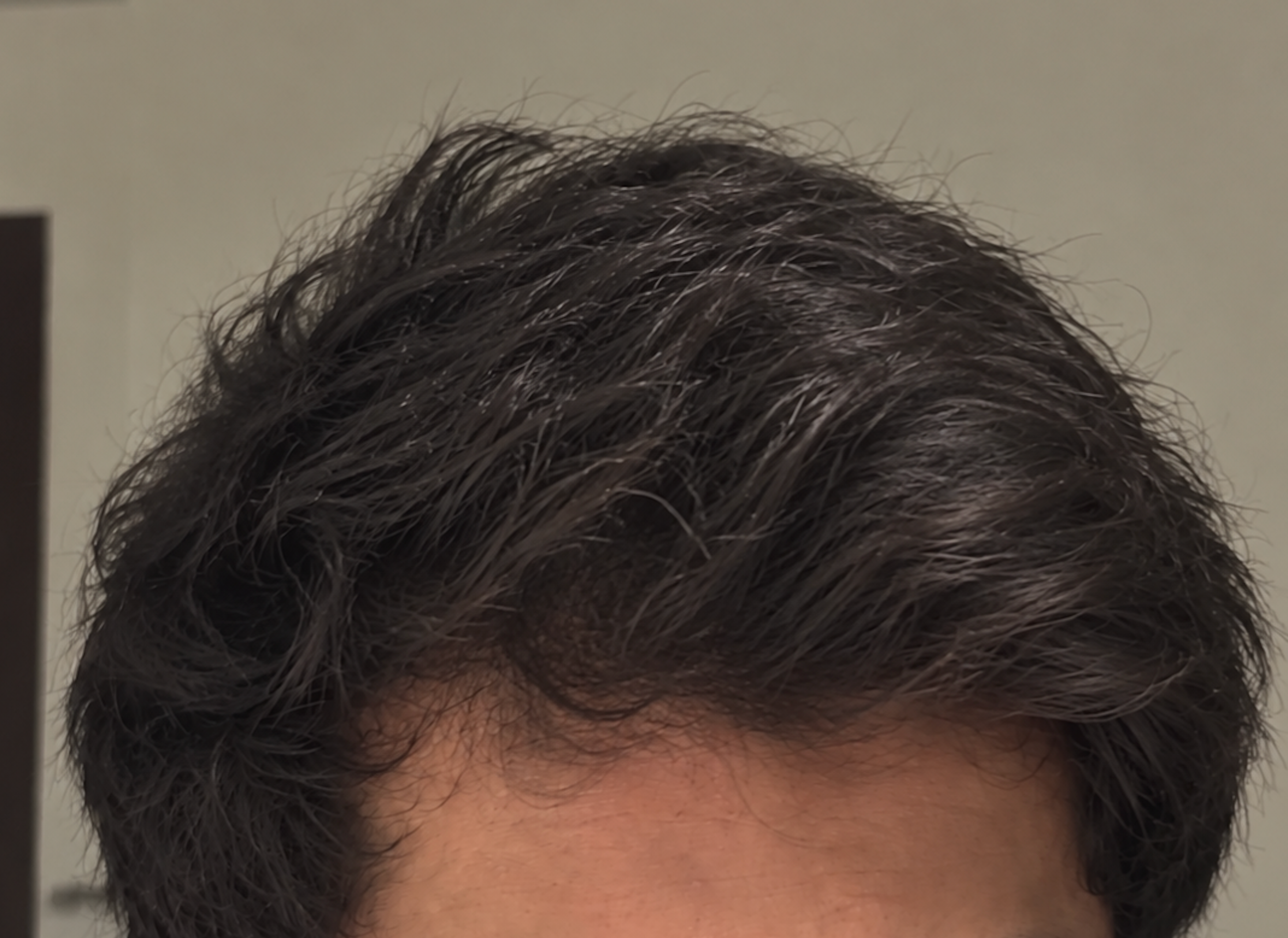Model's hair before using Enigma