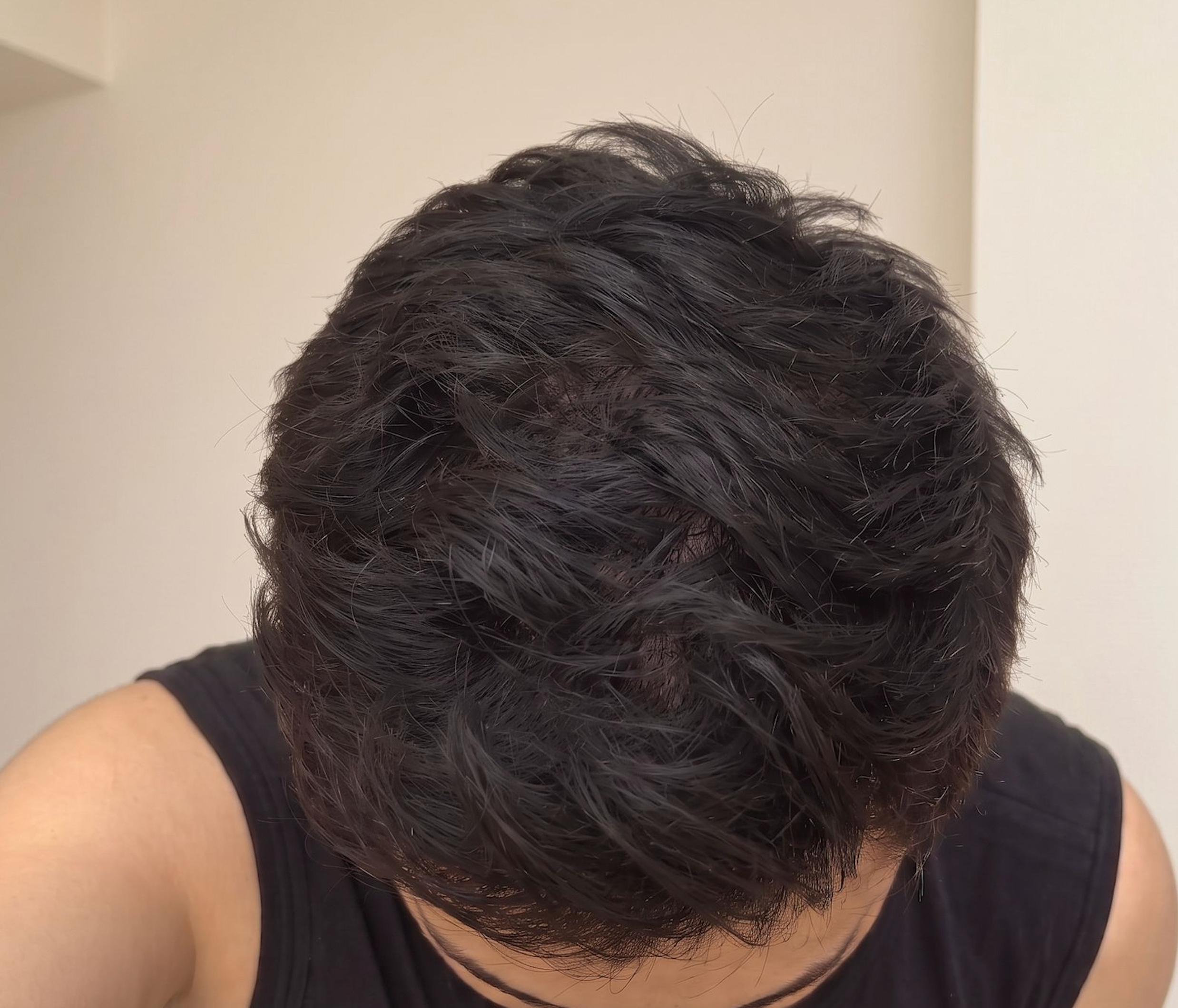 Arjun's hair after four months using Enigma