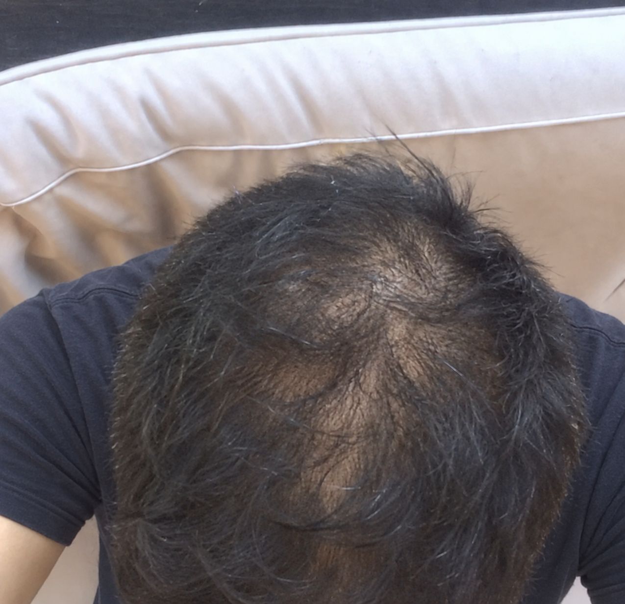 Arjun's hair before using Enigma