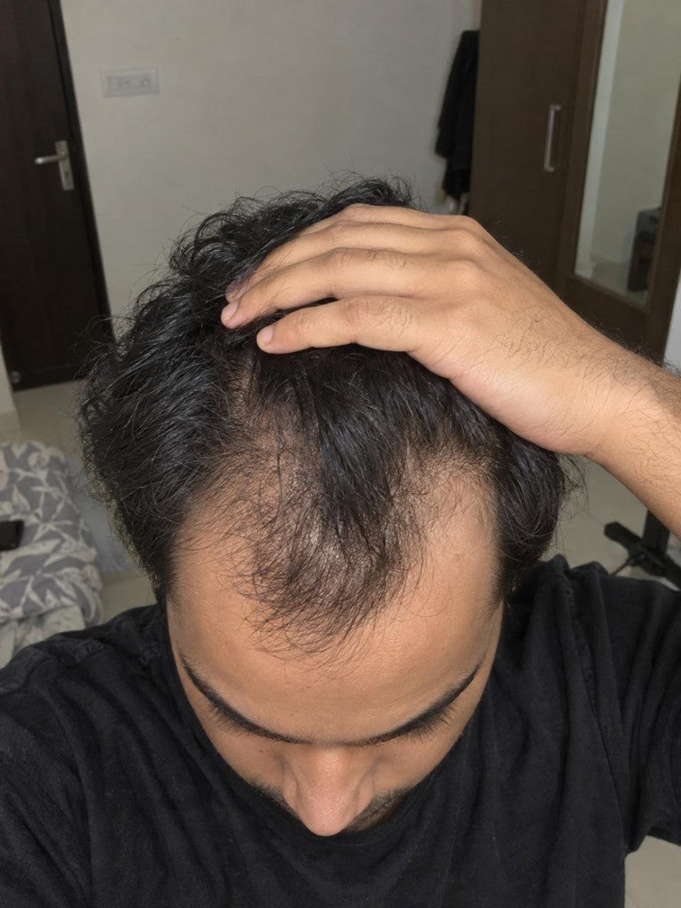 Rahul's hairline before using Enigma